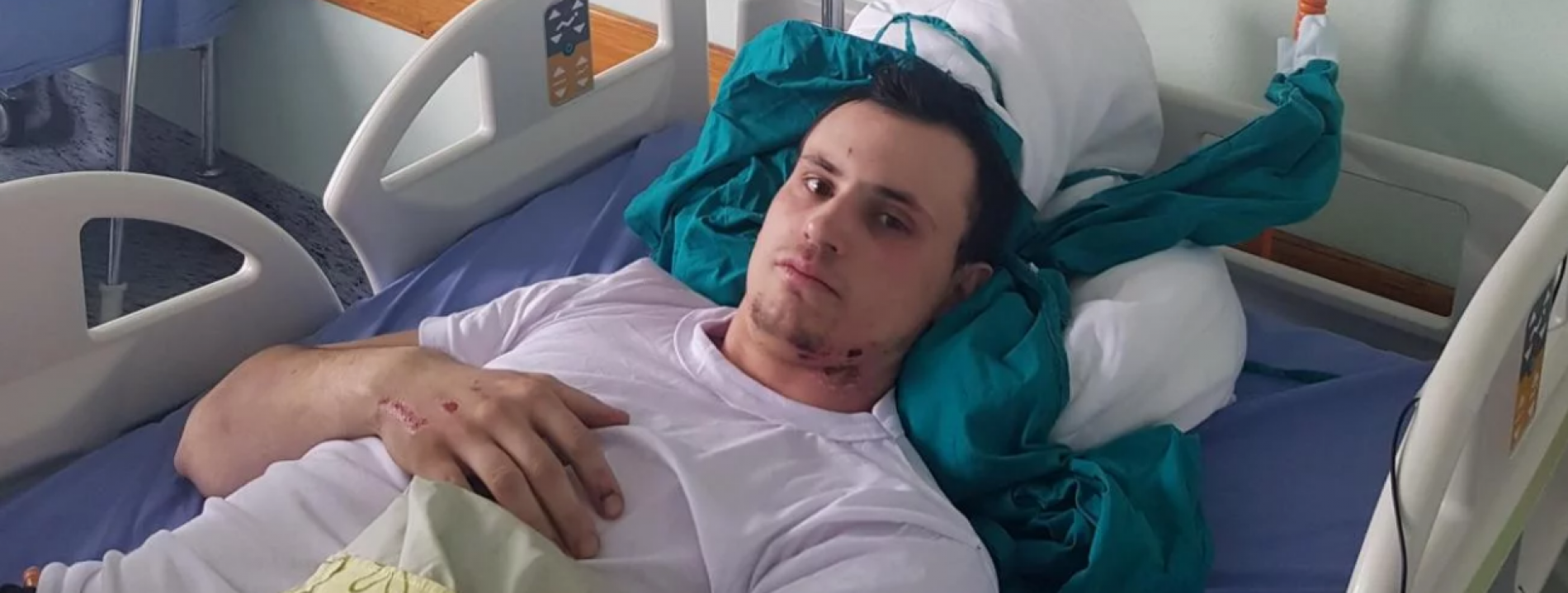 Ljekari KCUS-a uspješno izvršili replantaciju ruke 22-godišnjaku iz Busovače